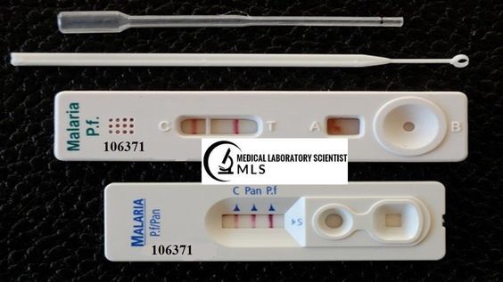 diagnostic paludisme